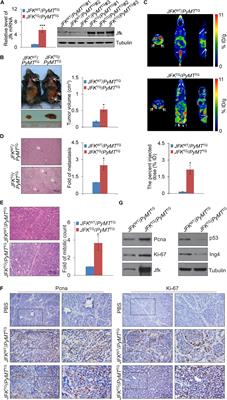 JFK Is a Hypoxia-Inducible Gene That Functions to Promote Breast Carcinogenesis